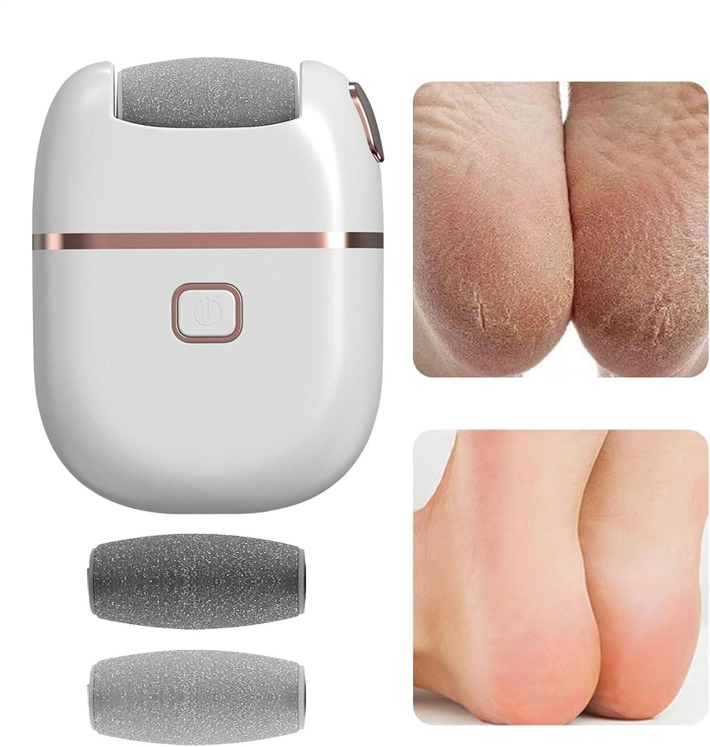 Electric Foot Callus Remover