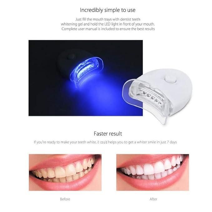 Teeth Whitening Kit